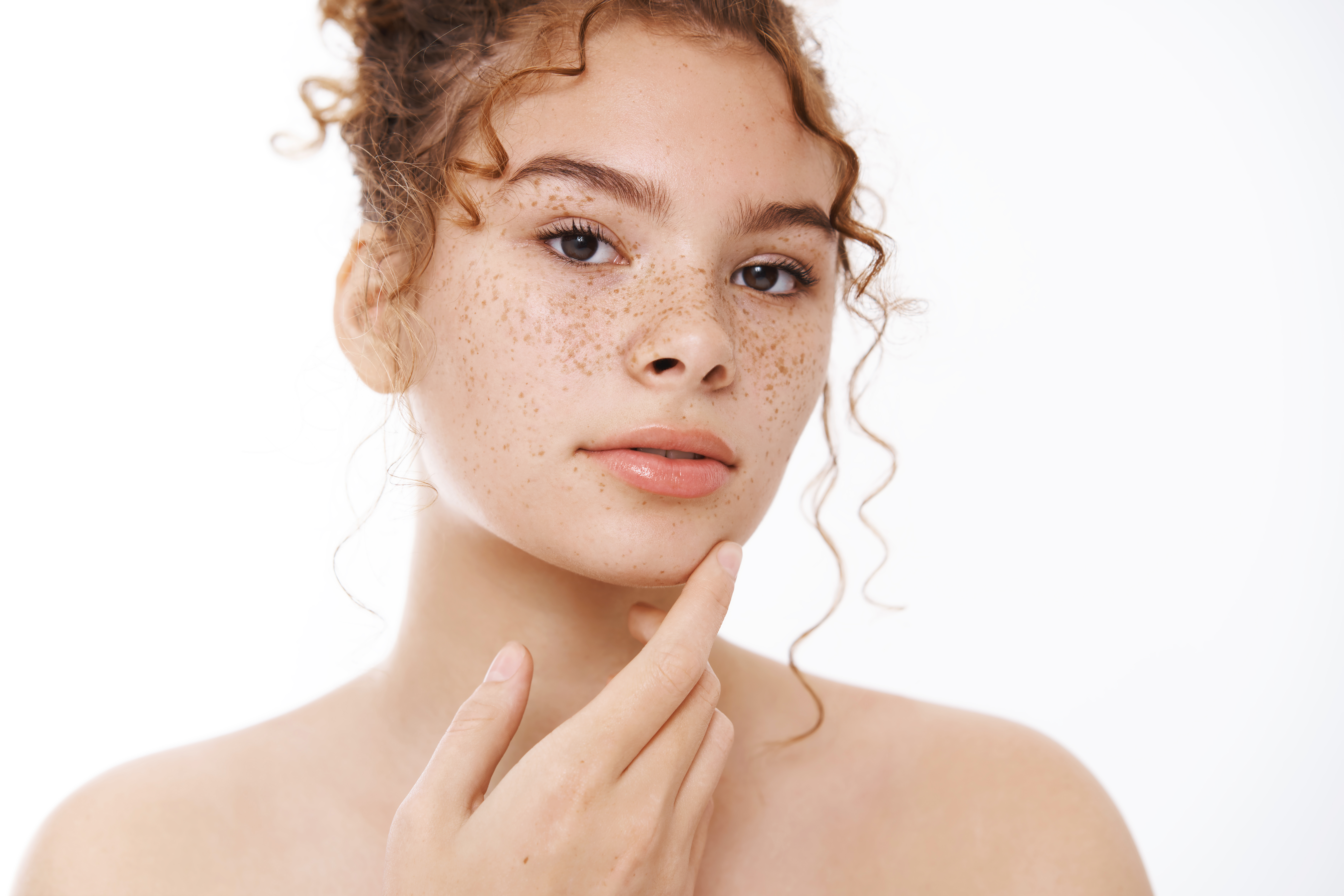 Dark Spots & Freckles