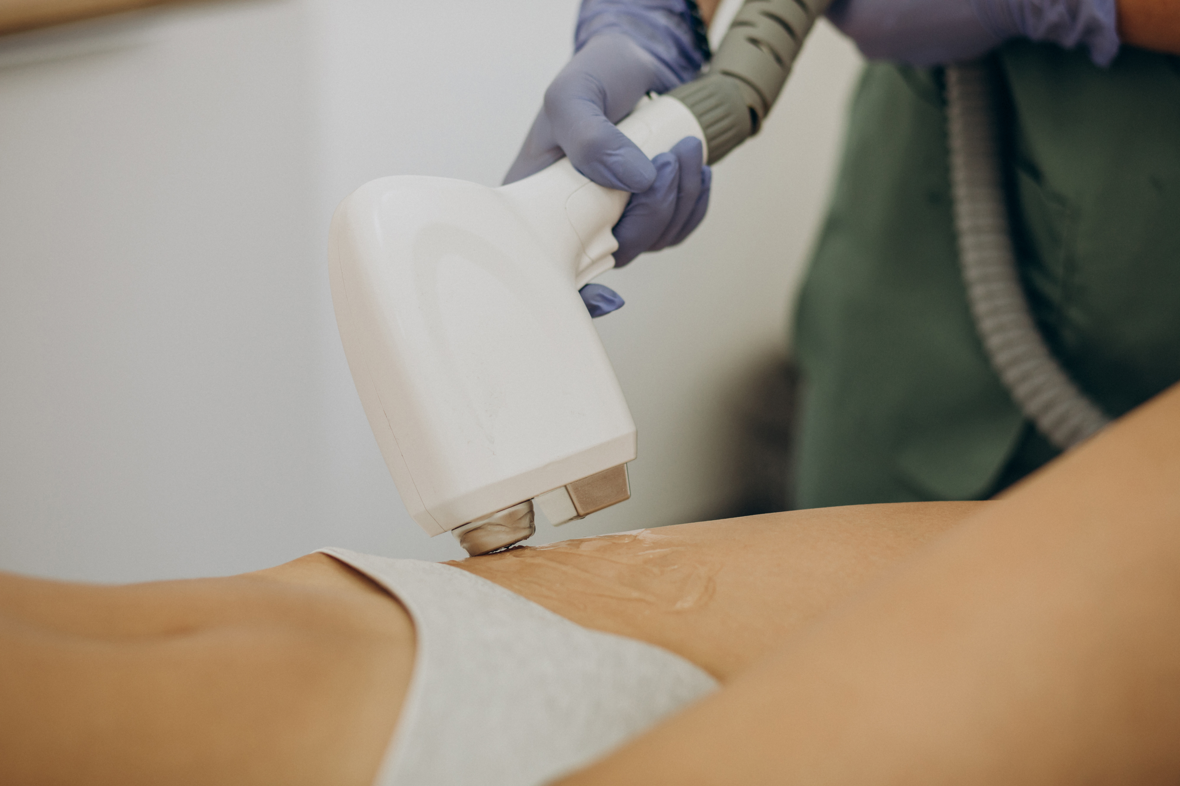 Bikini laser hair removal